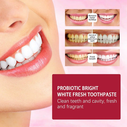 SP4 Oral Care Probiotic Whitening Toothpaste