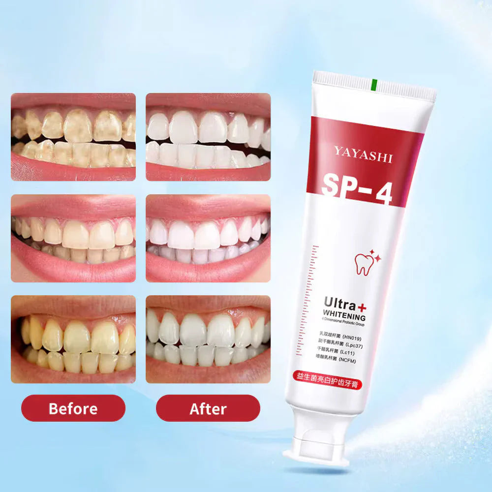 SP4 Oral Care Probiotic Whitening Toothpaste